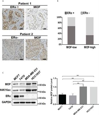 MOF negatively regulates estrogen receptor α signaling via CUL4B-mediated protein degradation in breast cancer